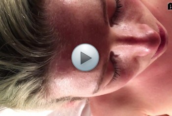 violastar: Gesichtsspritzer